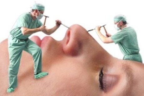 عمل بینی اقساطی